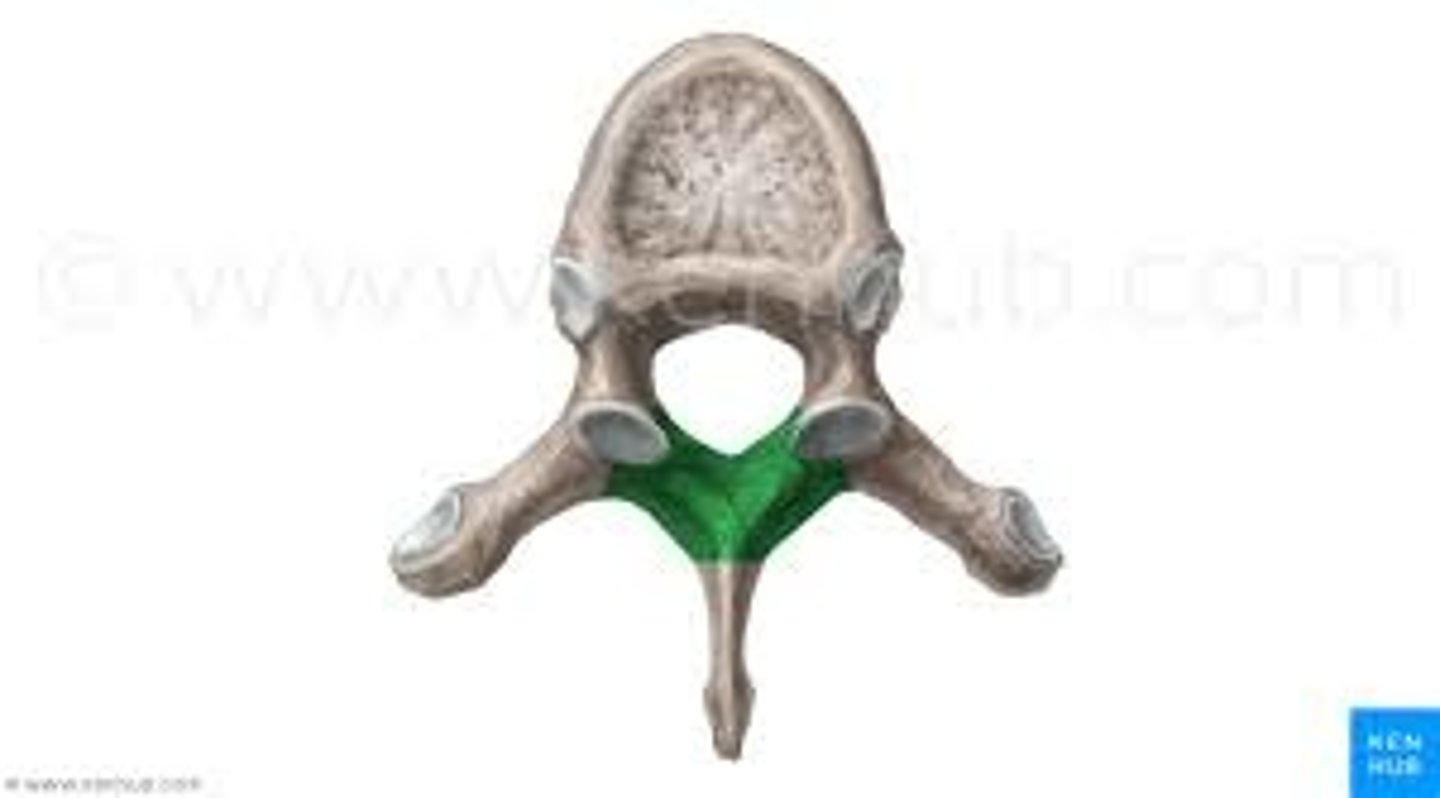 <p>expanded transverse process on the sixth cervical vertebra</p>