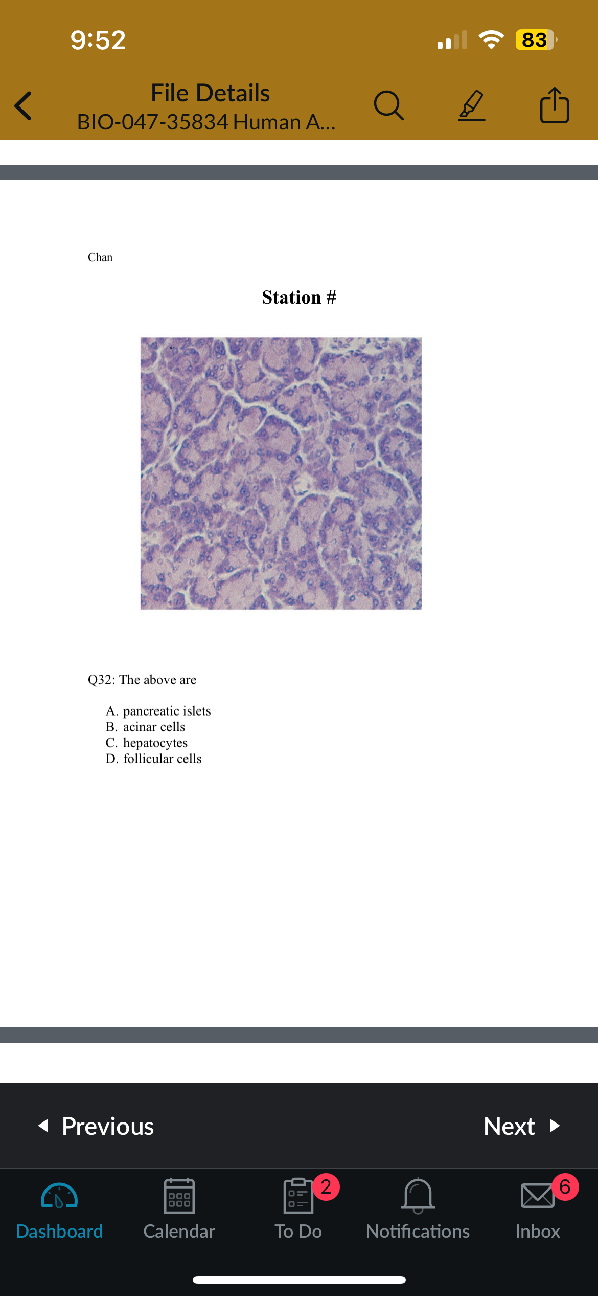 <p>Q32: The above are</p>