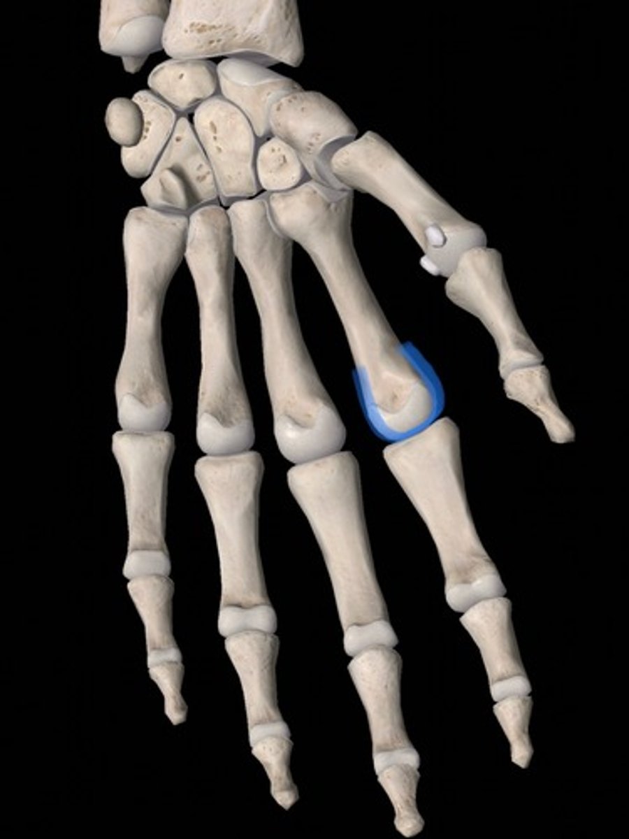 <p>bone</p>
