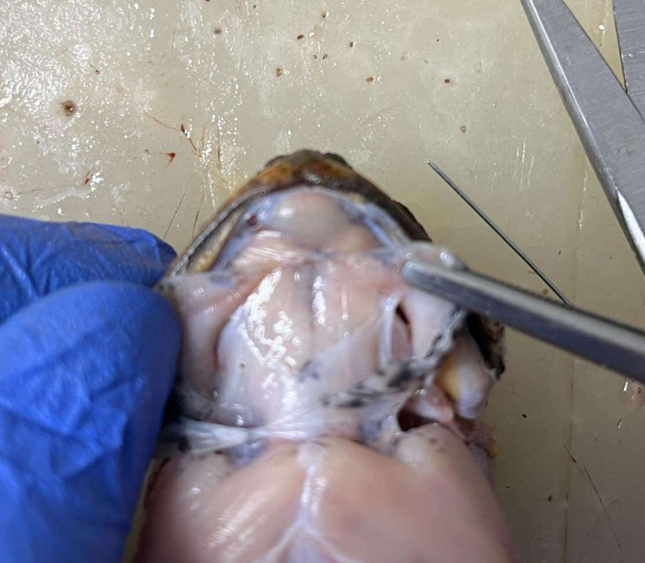 <p>the continuation of the rectus abdominis forward to the head under episternum</p>