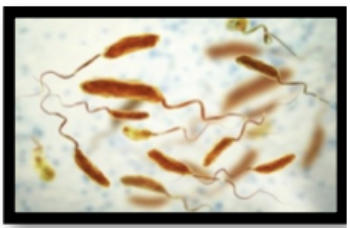 <p><span style="background-color: transparent; font-family: "Times New Roman", serif;"><strong><span>Describe each arrangement of flagella: Monotrichous:</span></strong></span></p>