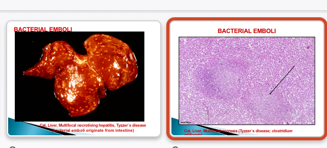 <p>Enterocolitis → organisms enter hepatic portal vein </p>