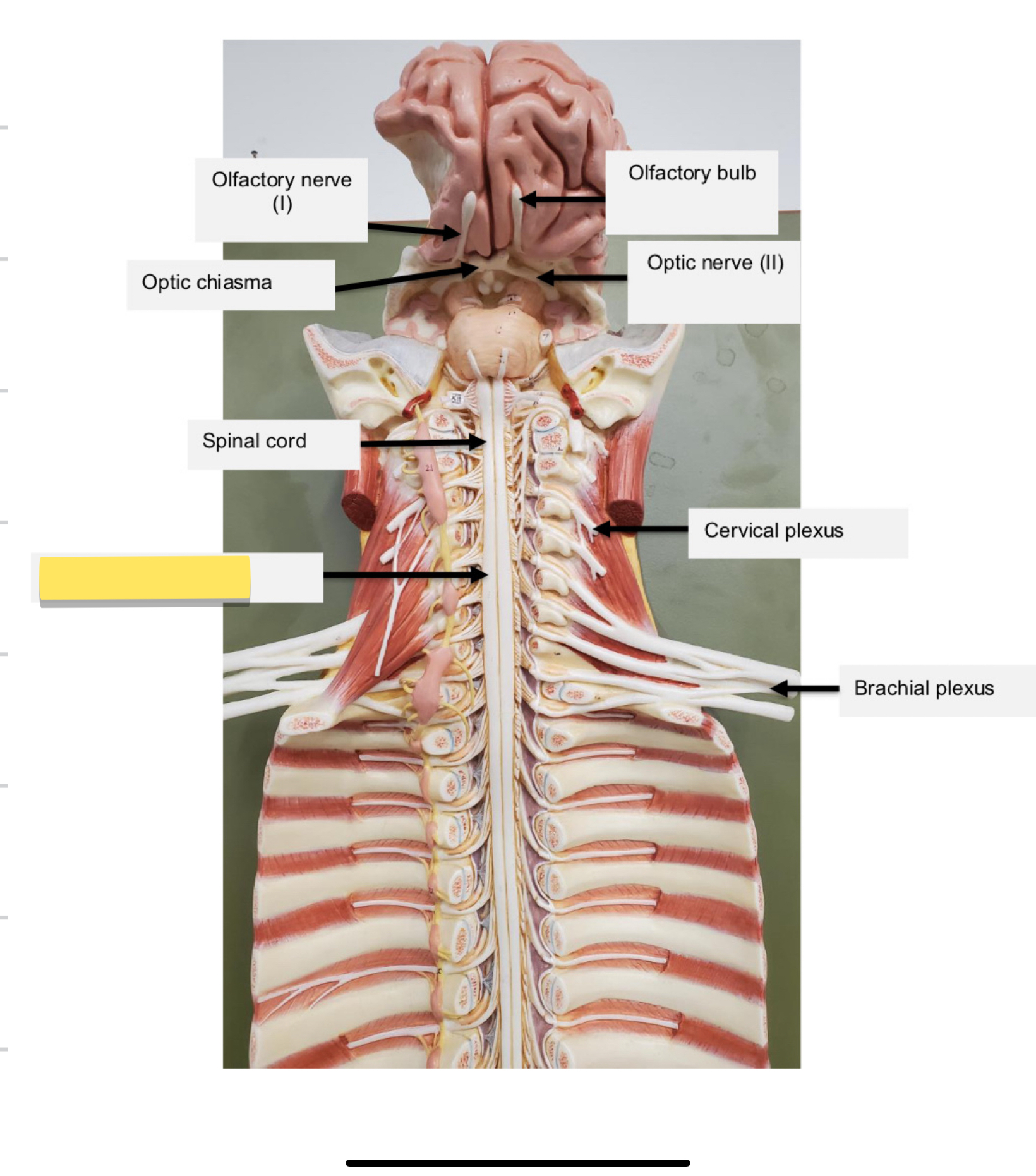<p>Name this part</p>