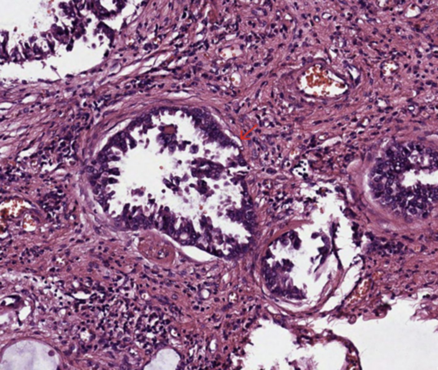 <p>Lung</p>