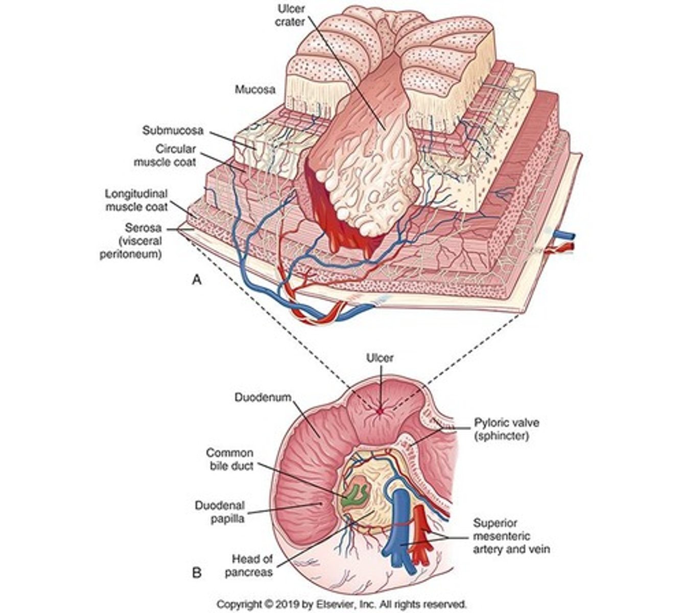 <p>Retrosternal pain, regurgitation of undigested food, unpleasant taste, vomiting, and weight loss.</p>