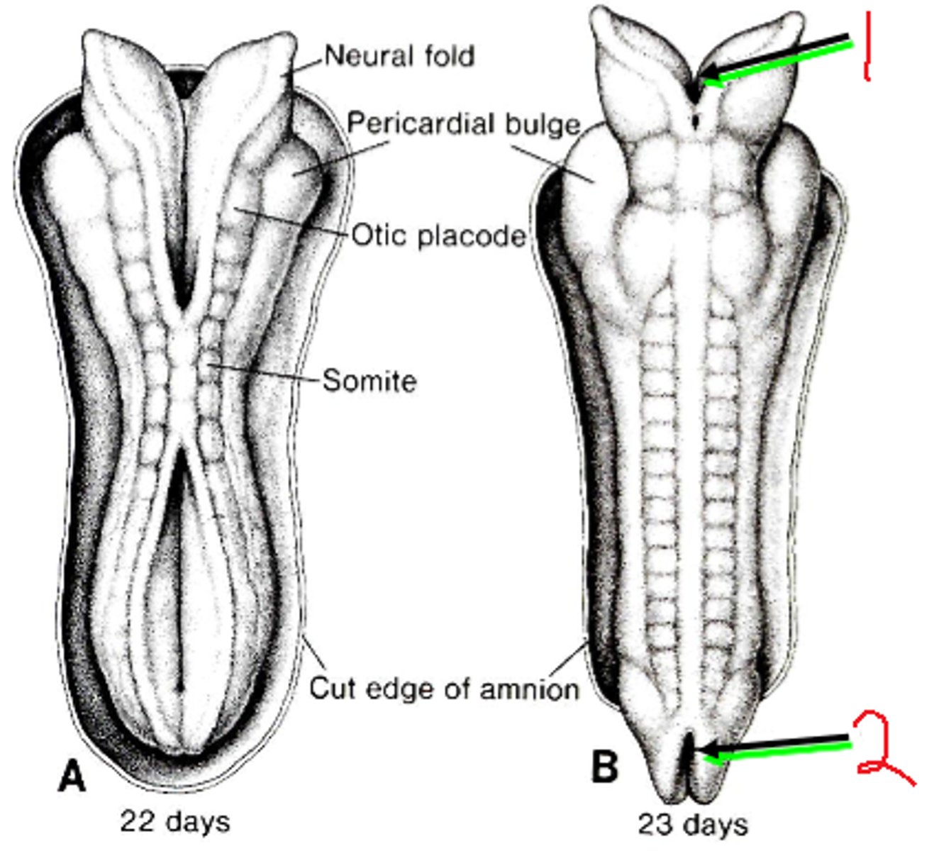 <p>caudal neuropore closes</p>