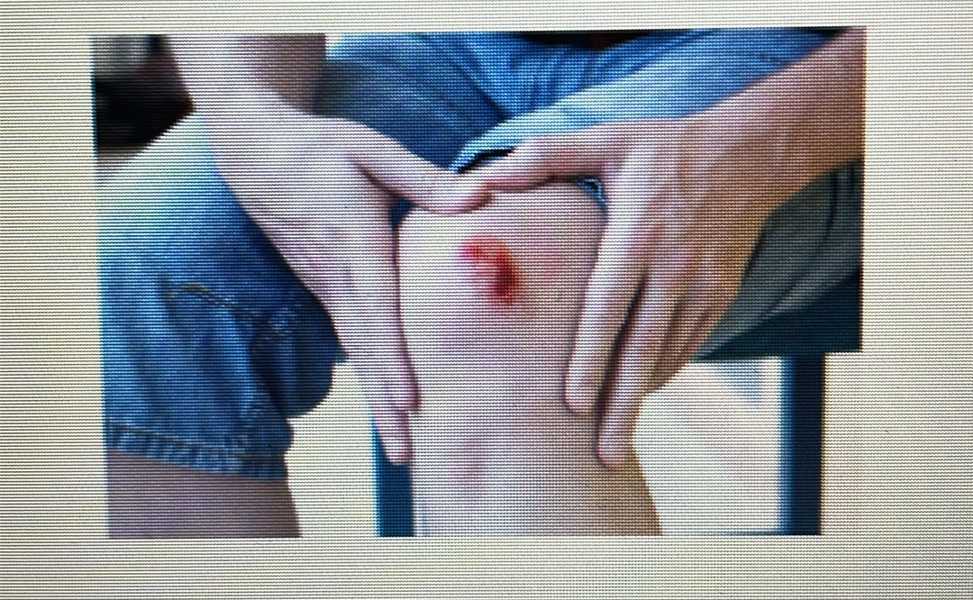 <p>WOUNDS</p>
