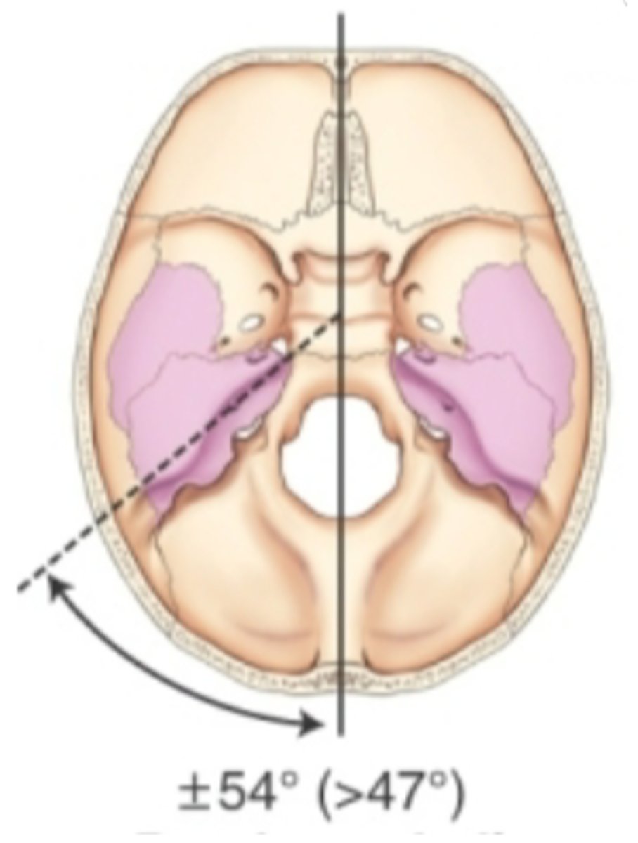 <p>Shorter, broader, wider skull</p><p>-width is 80% or more of length</p>