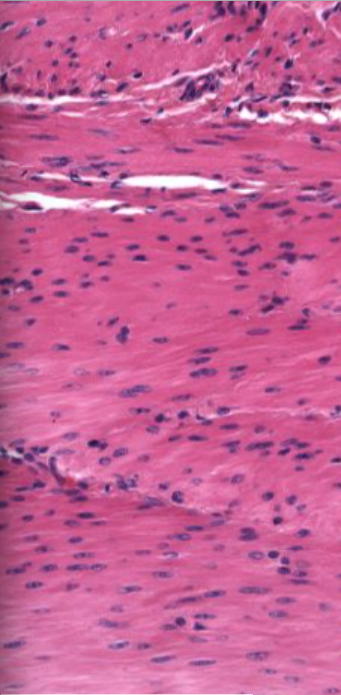 <p>Which muscle is this and how can you tell? (longitudinal section)</p>