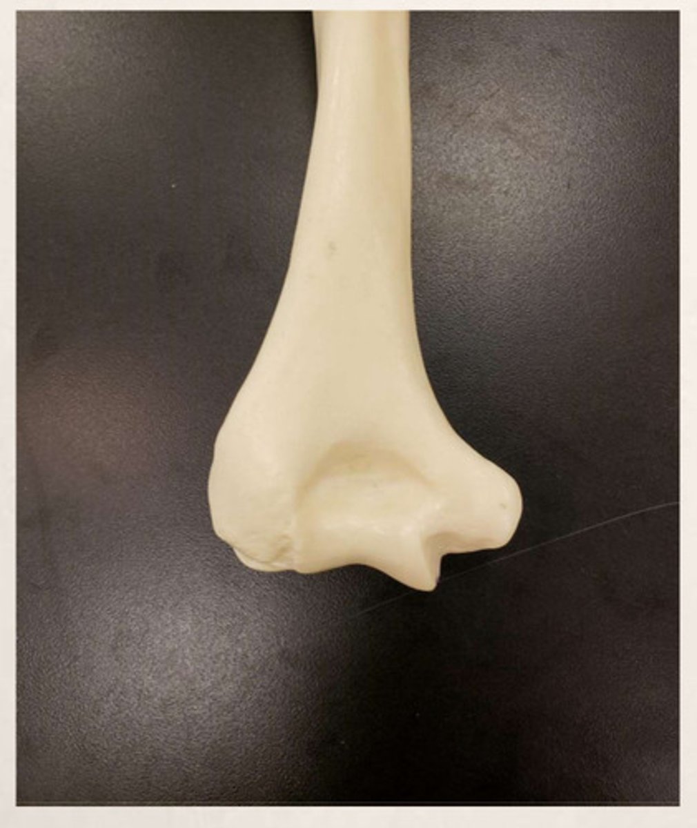 <p>anterior/posterior view of proximal/distal humerus?</p>
