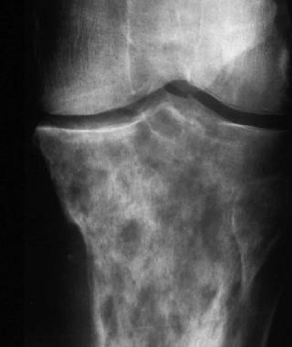 <p>full of small holes</p>