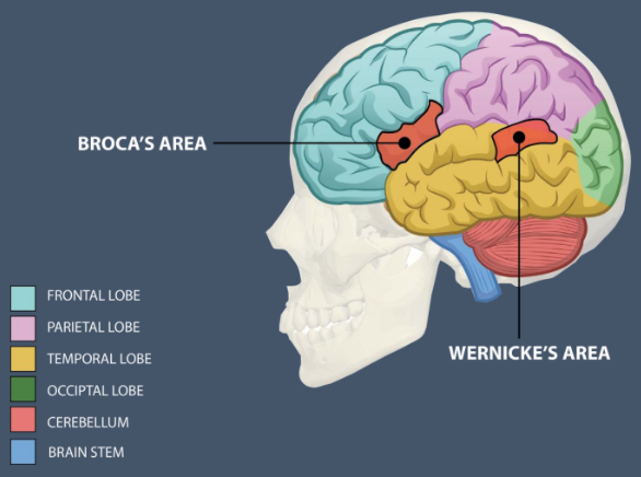 <ol><li><p><u>Temporal </u>lobe</p></li><li><p><u>Language </u>comprehension</p></li><li><p>Wernicke’s aphasia (“<u>fluent </u>aphasia”)</p></li></ol><p></p>