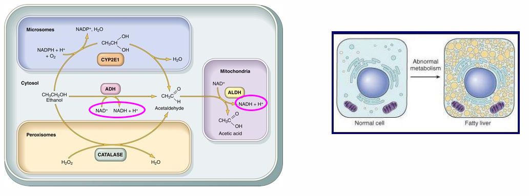 <p>- all pathways result in an increased NADH/NAD ratio</p><p>- decreased fatty acid oxidation -&gt; fatty liver (steatosis) --&gt; hepatitis</p>