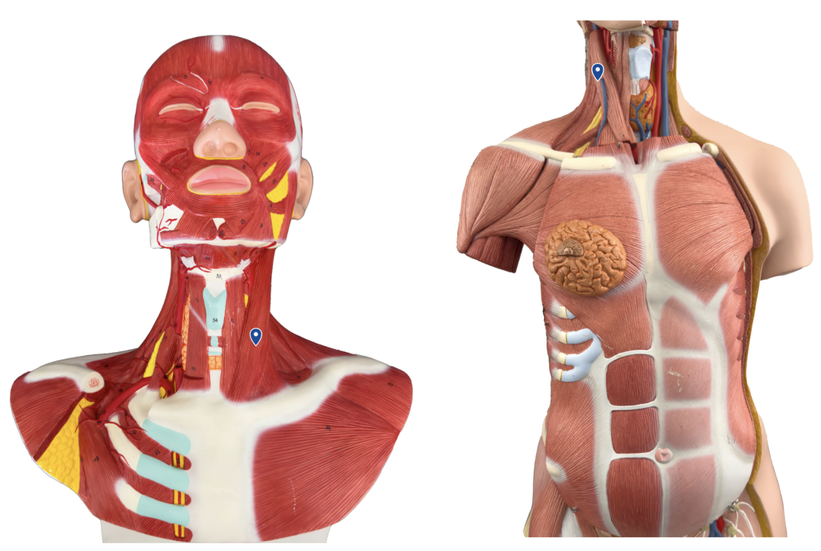 <p>What muscle is the arrow pointing to?</p>