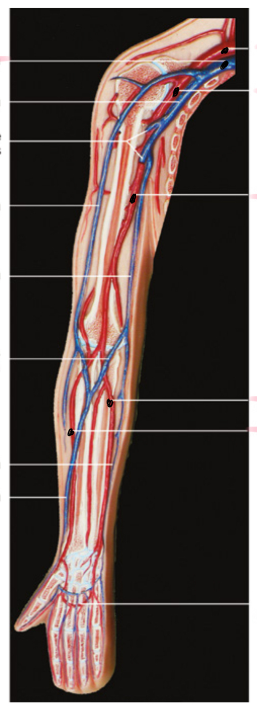 <p>Isvardink kraujagysles</p>