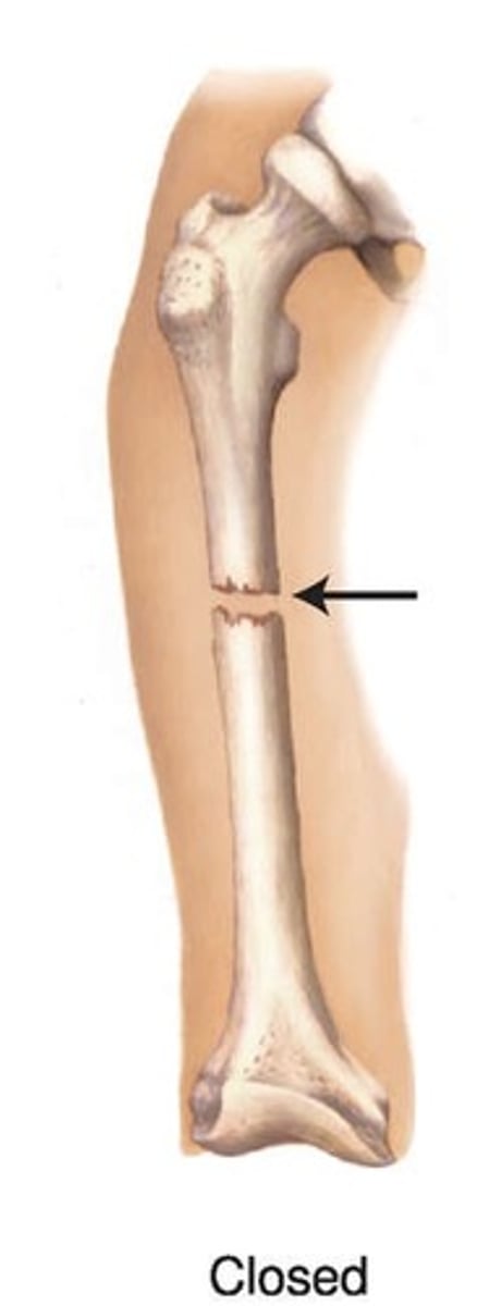 <p>Bone does not penetrate skin</p>