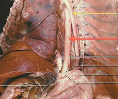 <p>carries food from mouth to stomach</p>