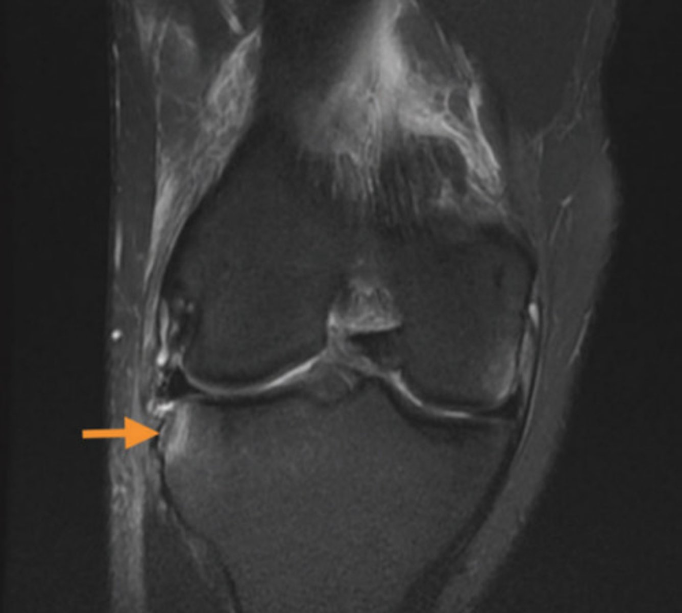 <p>coronal view</p><p>2 multiple choice options</p>