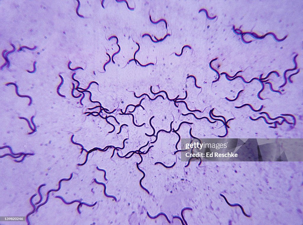 <p>What shape of bacteria is this?</p>