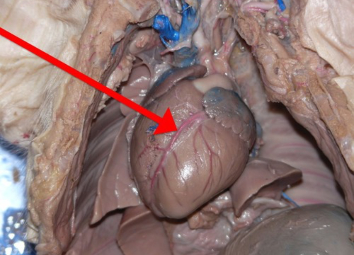 <p>Branches of the aorta that supply oxygenated blood to heart tissue itself.</p>
