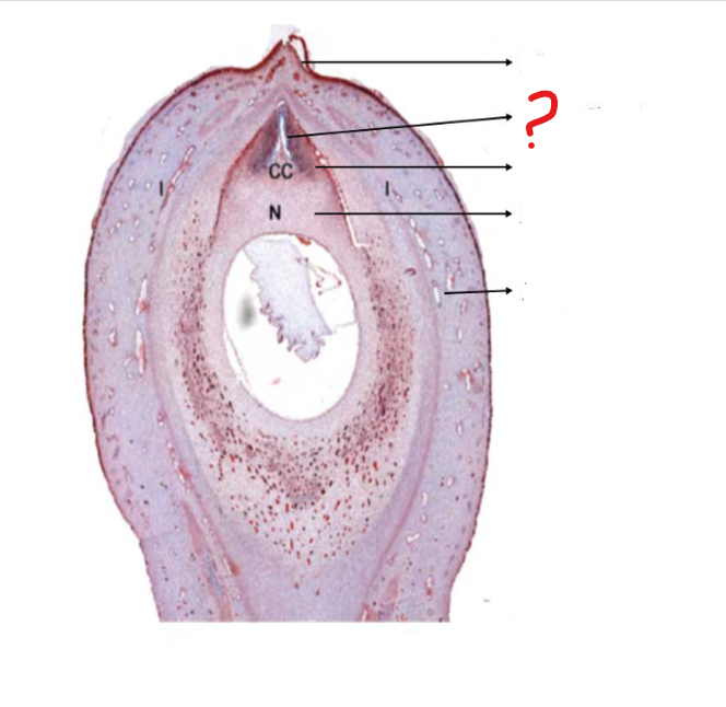 <p>identify the part labeled with a question mark; a small chamber at the apex of the nucellus in some plants (as most gymnosperms) for the reception of the pollen</p>