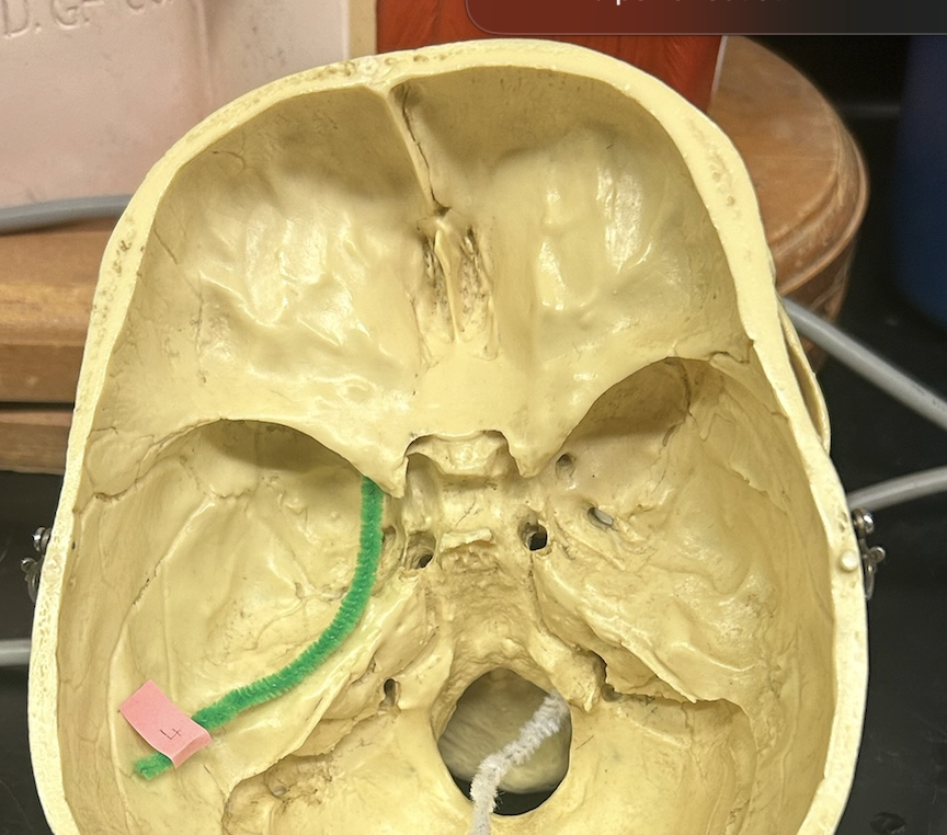 <p>what cranial nerves pass through the superior orbital fissure</p>