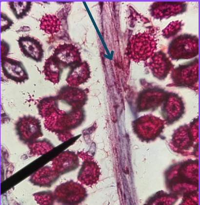 <p>Here’s a microscopic close up of Anthoceros’s Sporophyte. What structure is the blue arrow pointing at?</p>