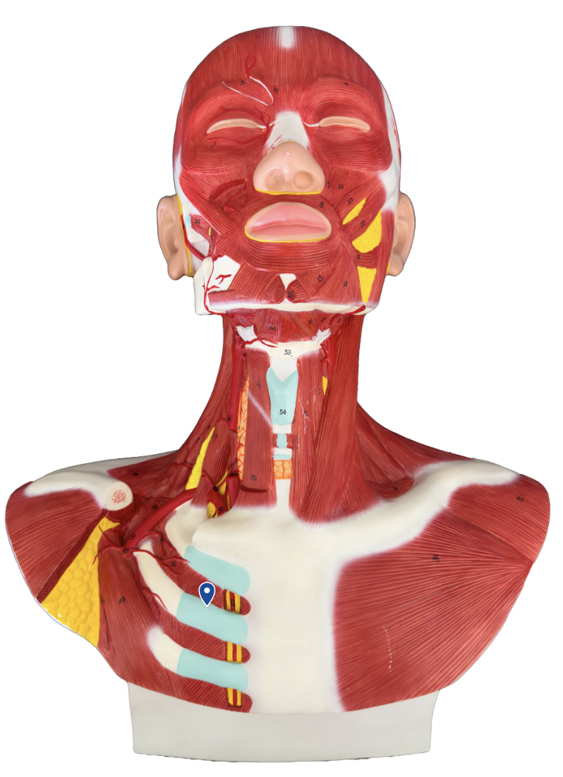 <p>What muscle is the arrow pointing to?</p>