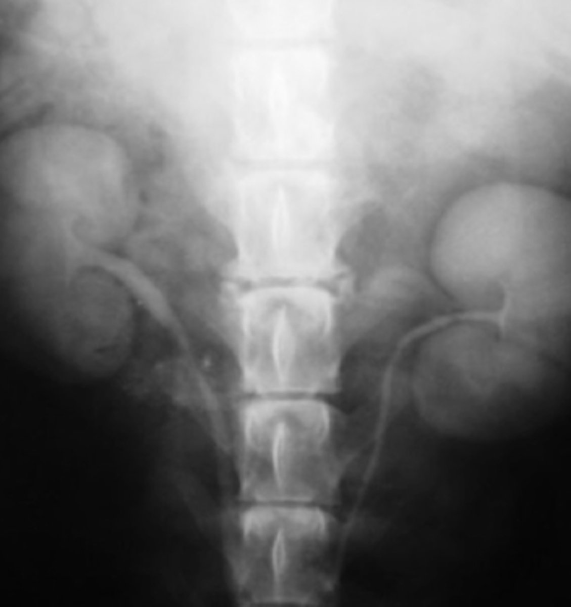 <p>what contrast method is used in this radiograph?</p>