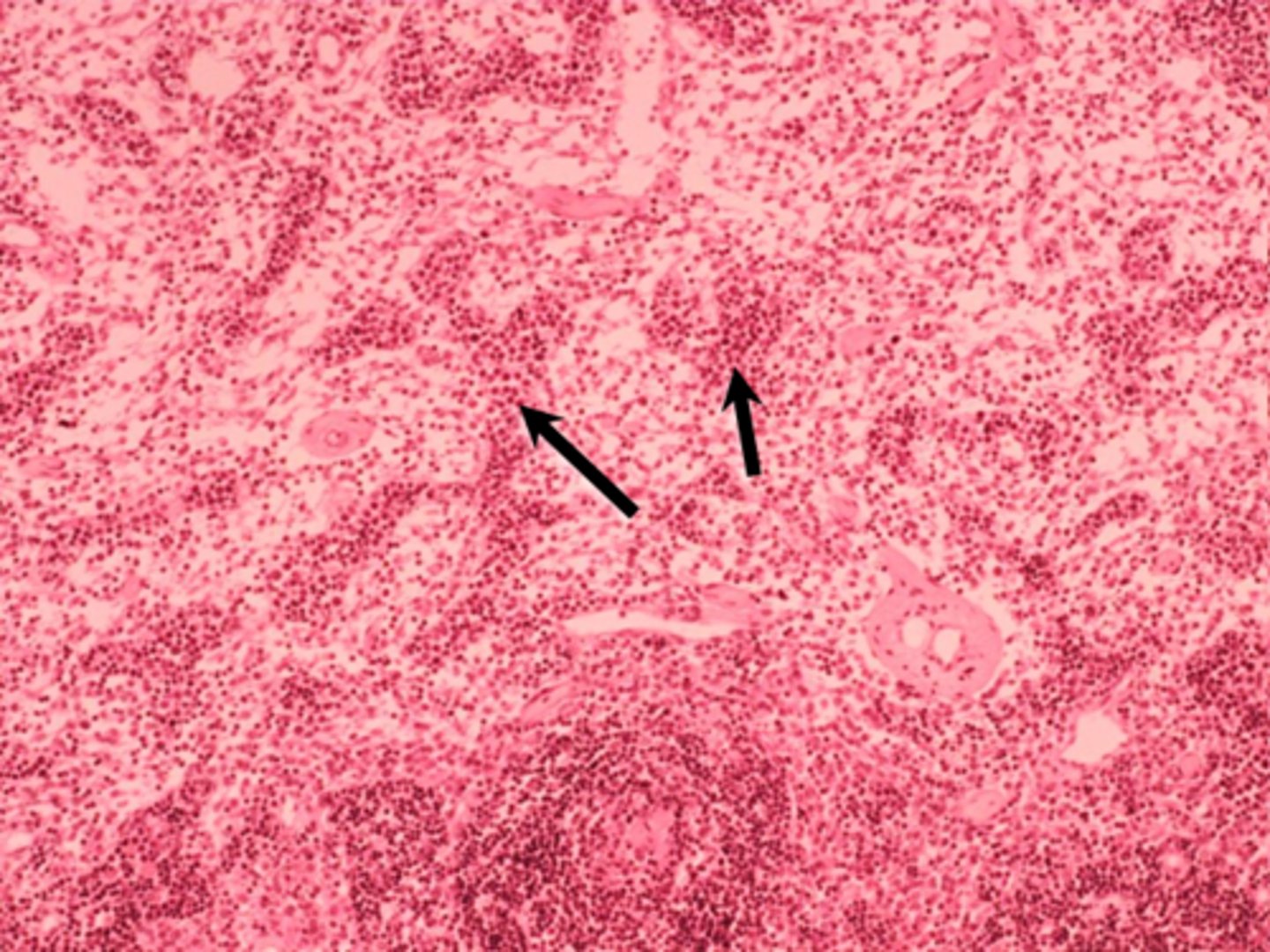 <p>black arrows</p><p>medullary cords</p>