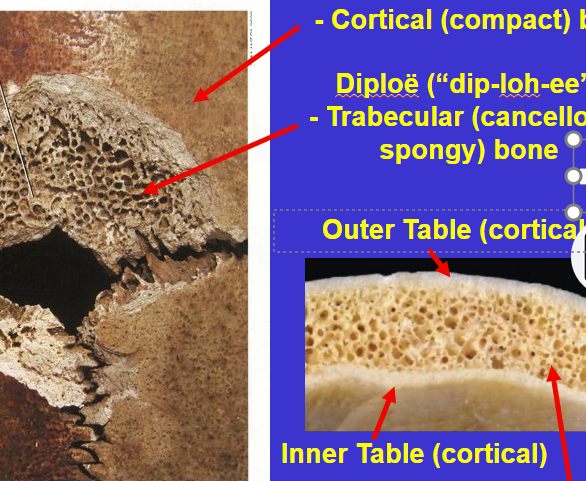 <ol><li><p><strong>Outer Table</strong> = Cortical (compact) bone</p></li><li><p><strong>Diploe </strong>= Trabecular (cancellous, spongy) bone with <u>rounded </u>spaces</p></li><li><p><strong>Inner table</strong> = cortical bone</p></li></ol><p></p>