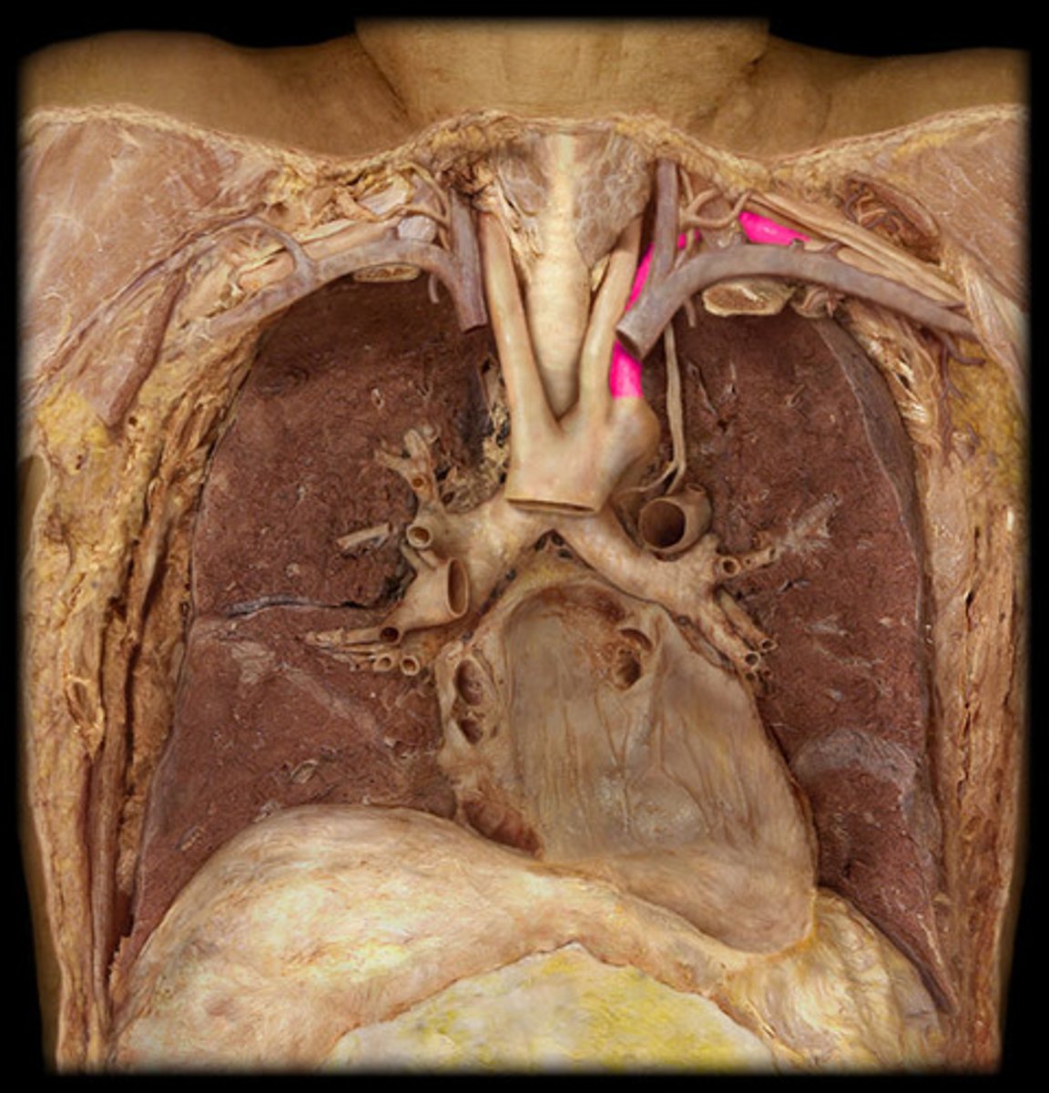 <p>third branch of the aortic arch</p>