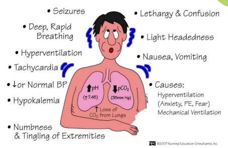 <ul><li><p>high pH, low CO2</p></li><li><p>seizures, confusion, nausea, decreased/normal BP, decreased potassium</p></li><li><p>causes: hyperventilation (stress), mechanical ventilation</p></li></ul>