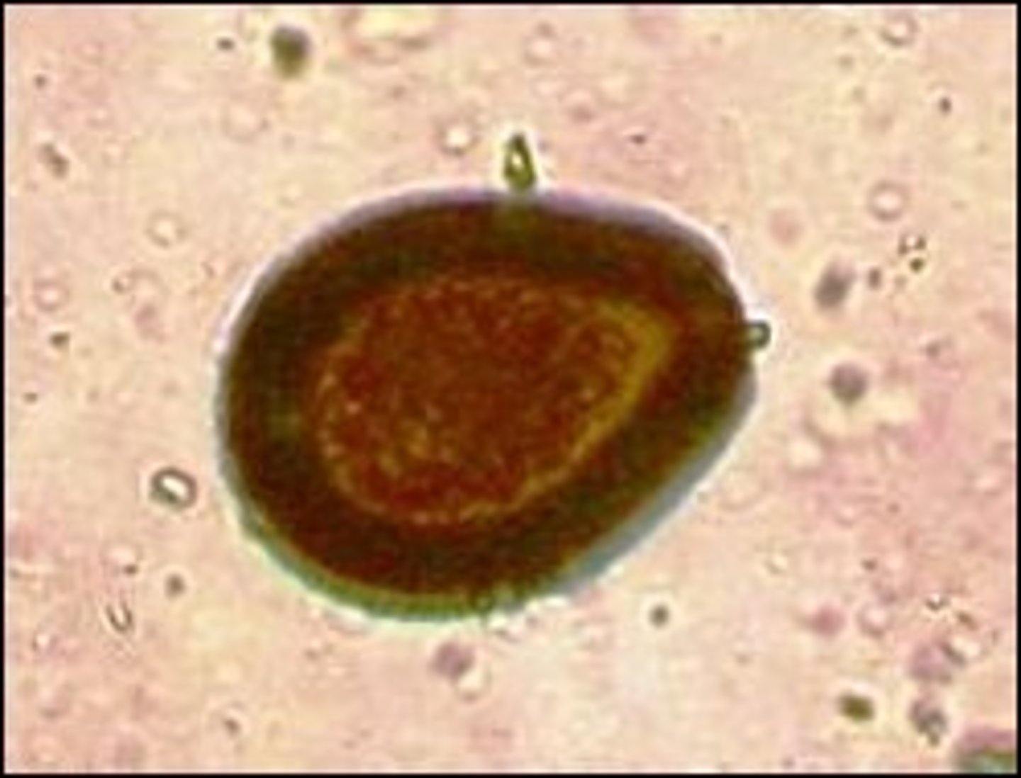 <p>What is the name of the highly pathogenic GI parasite in camelids that can cause diarrhea, weight loss, hypoproteinemia, dehydration, and death? How do you treat?</p>