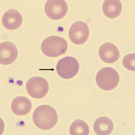 <p>What is the inclusion in this erythrocyte?</p>