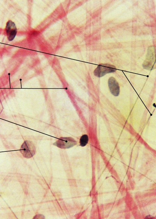 <p>Which type of connective tissue has:</p><ul><li><p>Open framework, viscous ground substance</p></li><li><p>Holds blood vessels and capillary beds</p></li><li><p>Under skin (subcutaneous layer)</p></li></ul><p></p>