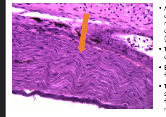 <p>what tissue is this </p>