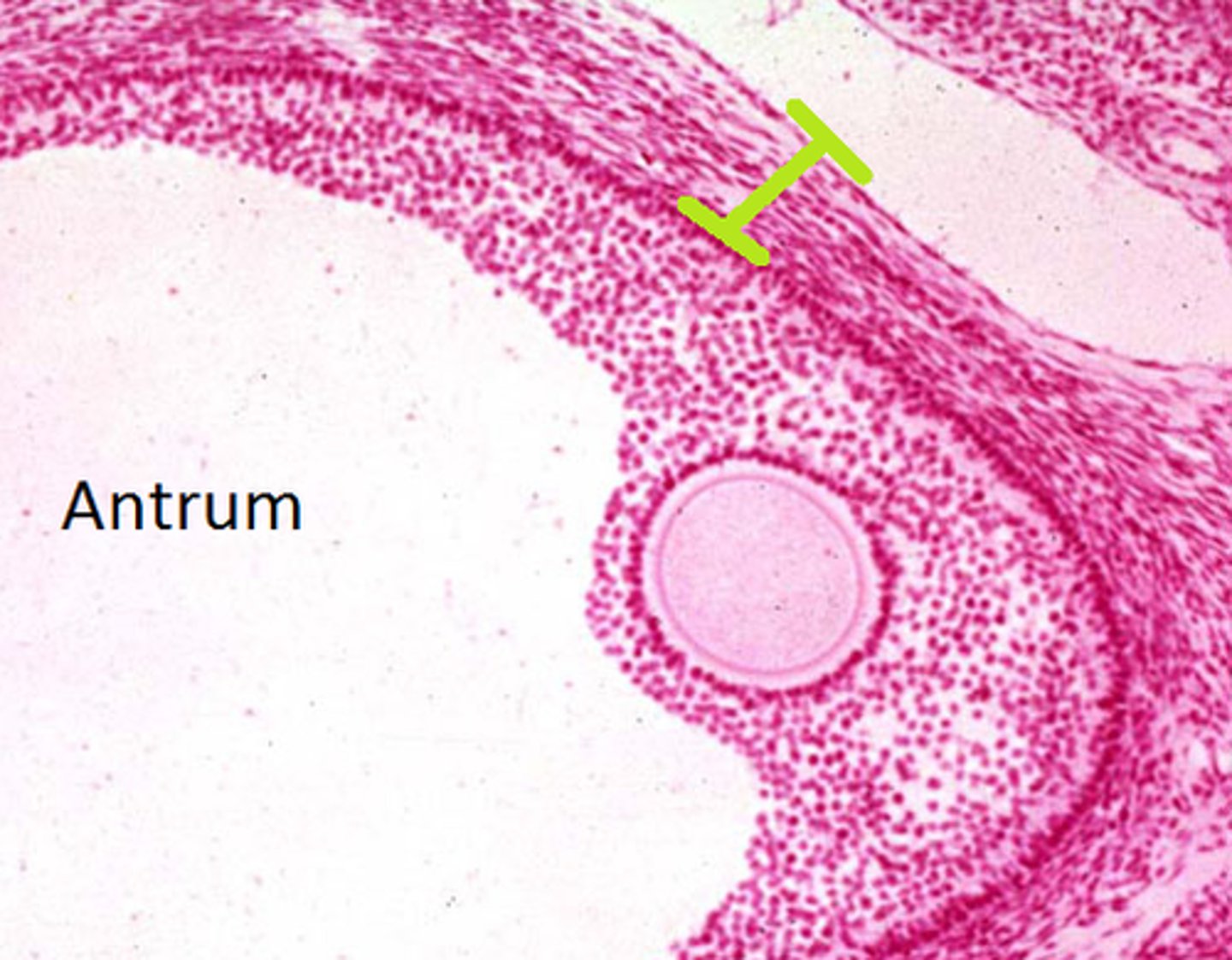 <p>A layer of cells surrounding the granulosa cells of the follicles in an ovary (the outer layer of follicles)</p><p>- help produce the estrogen secreted from the follicle during the first phase of the ovarian cycle, which is needed for antrum formation</p><p>- stimulated by LH</p><p>- converts cholesterol into androgens</p><p>- female version of Leydig cells, as they are developed from same precursor (due to LH stimulation - males)</p>