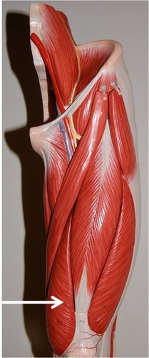 <p>Name this muscle</p>