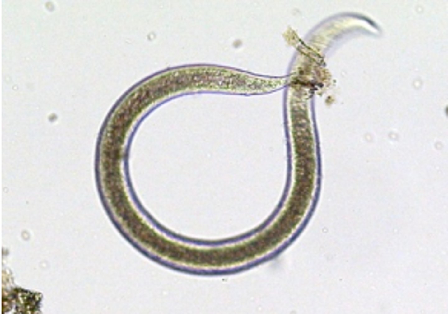 <p>Nematodes<br>Phylum Nematoda</p>
