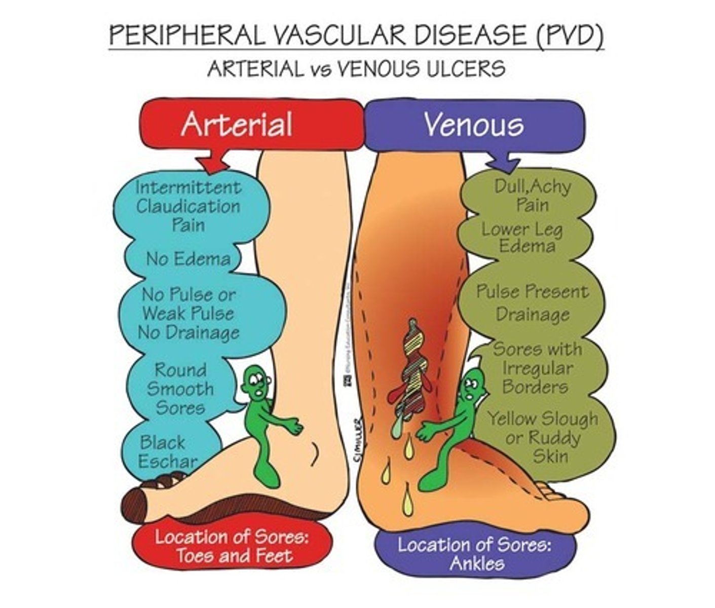 <p>- Proximal to the medial malleolus VENMO Venous = medial malleolus.</p><p>- Irregular, shallow appearance</p><p>- Flaking, brownish discoloration - hemosiderin staining</p><p>- Wet wound</p><p>- Mild to moderate pain</p><p>- Elevation decrease pain</p><p>- Can be bilateral or unilateral. Bilateral cases often due to systemic issues like chronic venous insufficiency, unilateral cases usually due to DVT or trauma.</p>