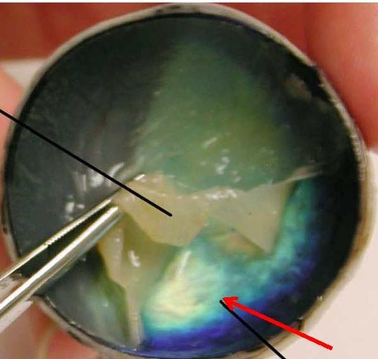 <p>Shiny coating located on top of choroid in animals which reflects light and amplifies night vision (humans do not have)</p>