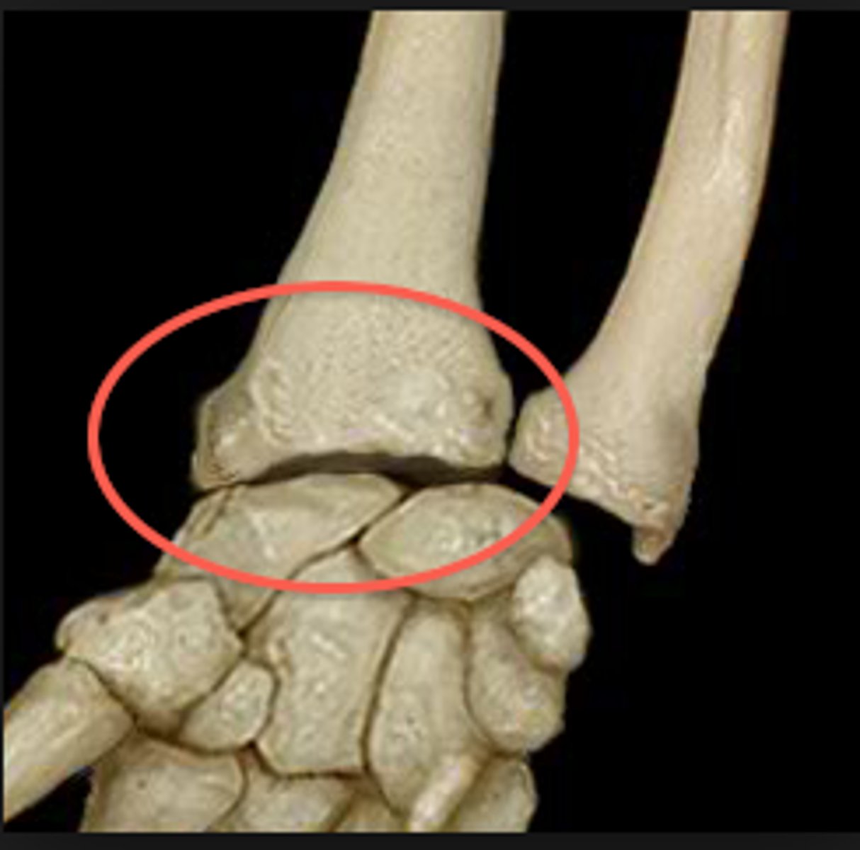 <p>- articulation of the distal radius with the proximal row of carpal bones</p><p>- condyloid type of synovial joint</p><p>- permits flexion/extension and radial/ulnar deviation of the wrist</p>