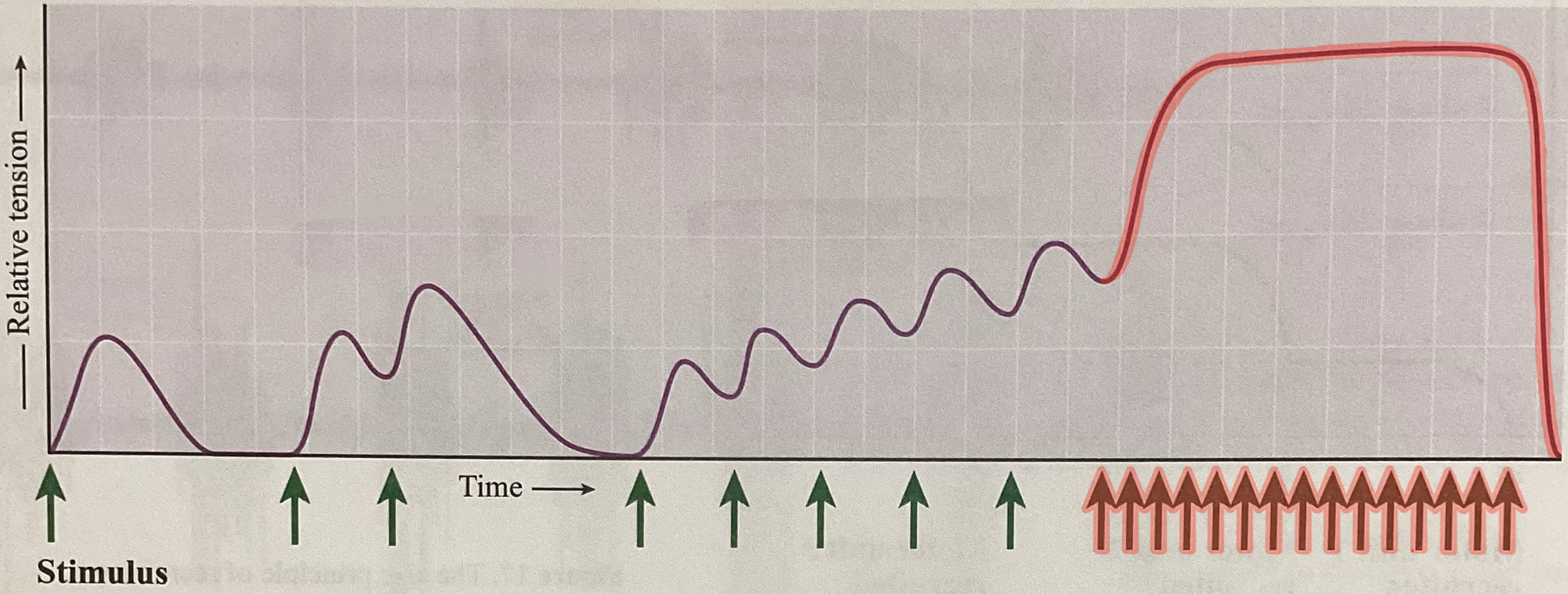 <p>What type of contraction is this?</p>