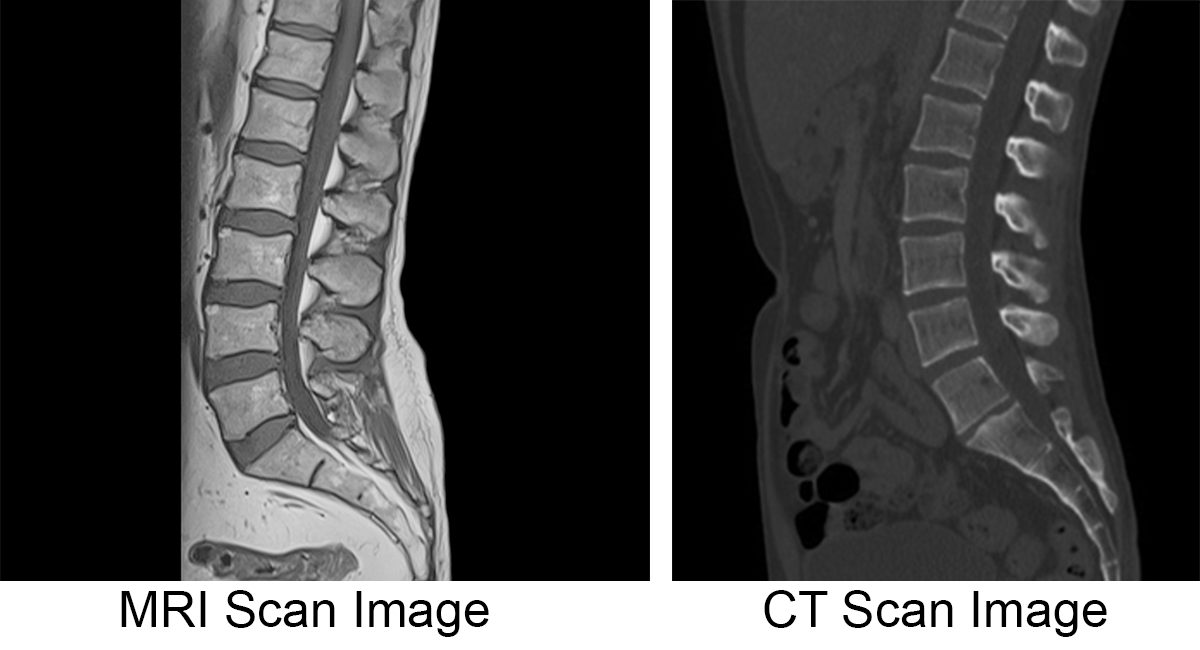 <p>Brain-imaging method using <strong>radio waves and magnetic fields</strong> of the body to produce detailed images of the brain.</p>