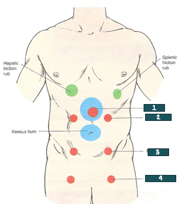 <p>What artery is auscultated @ #4?</p>