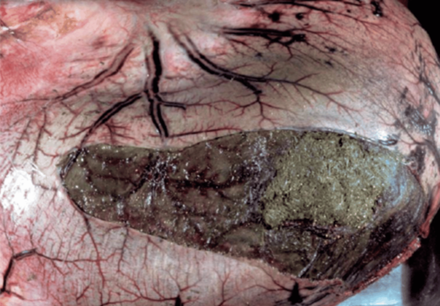 <p>¿rotura gástrica ante o post mortem?</p>