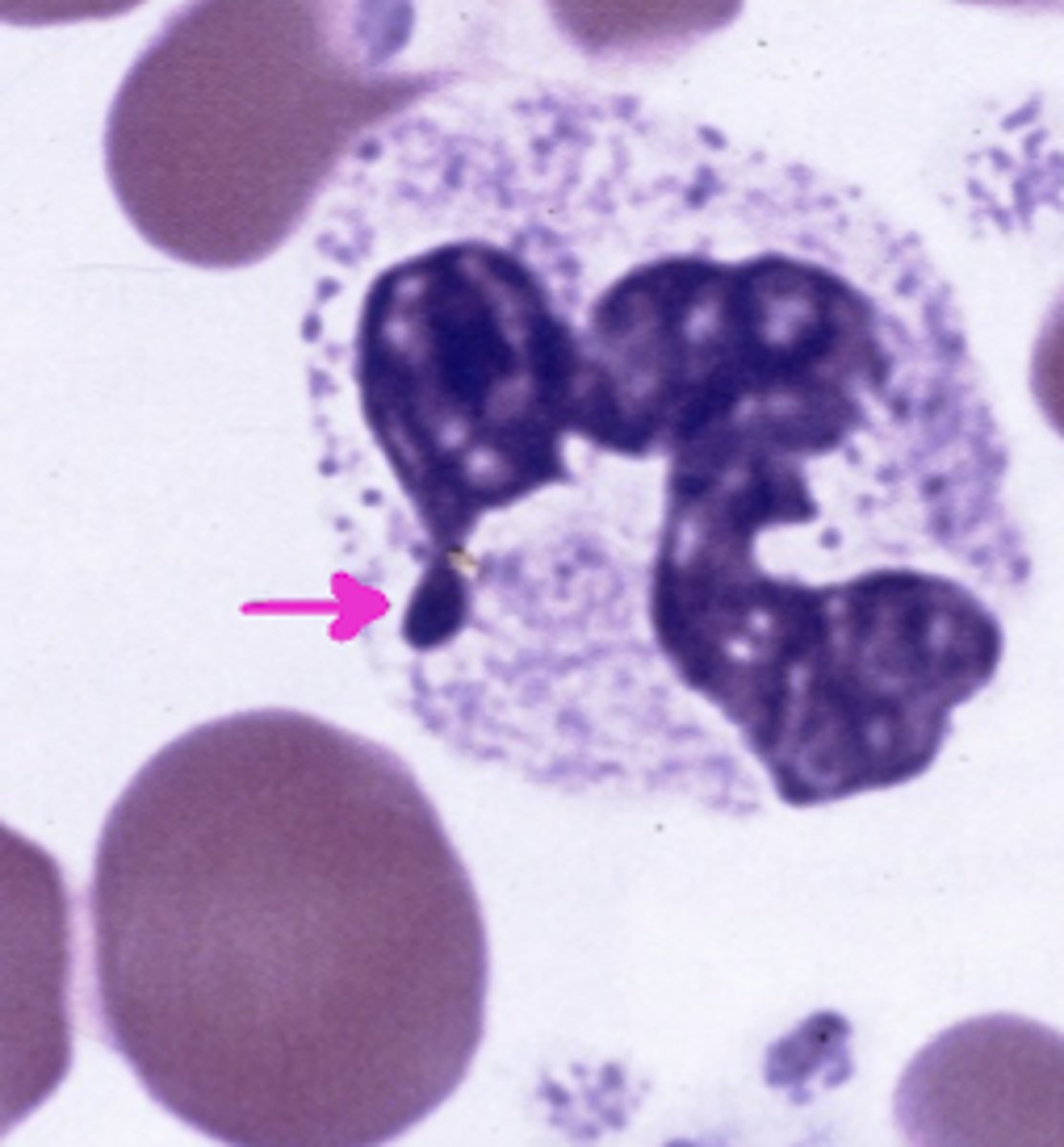<p>what does the arrow point to?</p>