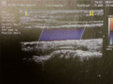 <p>Use the color Doppler image to answer the question regarding the direction of flow in a rectangular image with a steered box</p>