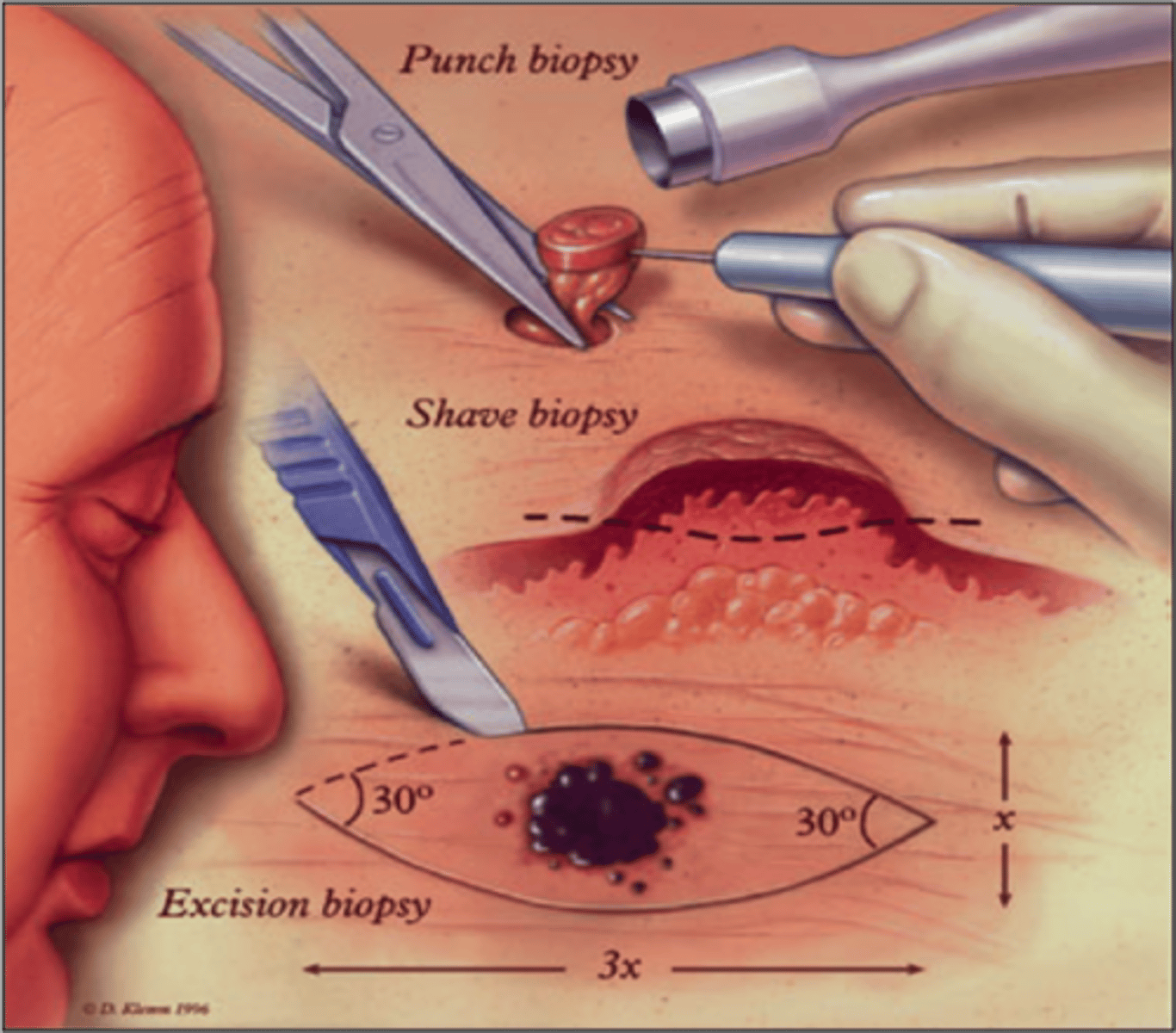<p>Obtain tissues for histologic examination.</p>